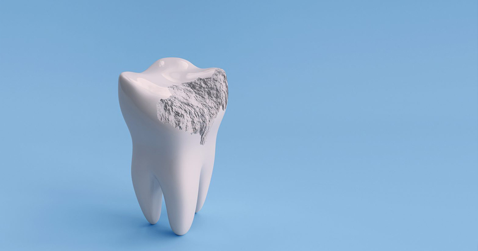 فرسایش مینای دندان: آنچه باید بدانید