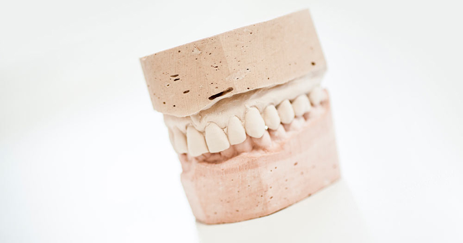 تحلیل دندان چیست؟
