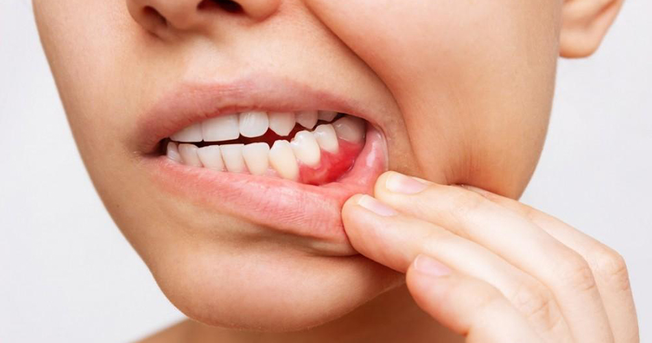 15 مشکل دندانی