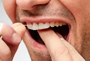 عدم وجود فاصله کافی بین دندان ها برای نخ دندان