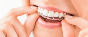 الاینر شفاف Clear Aligners: نامرئی و راحت