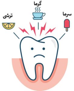 علل حساسیت دندان